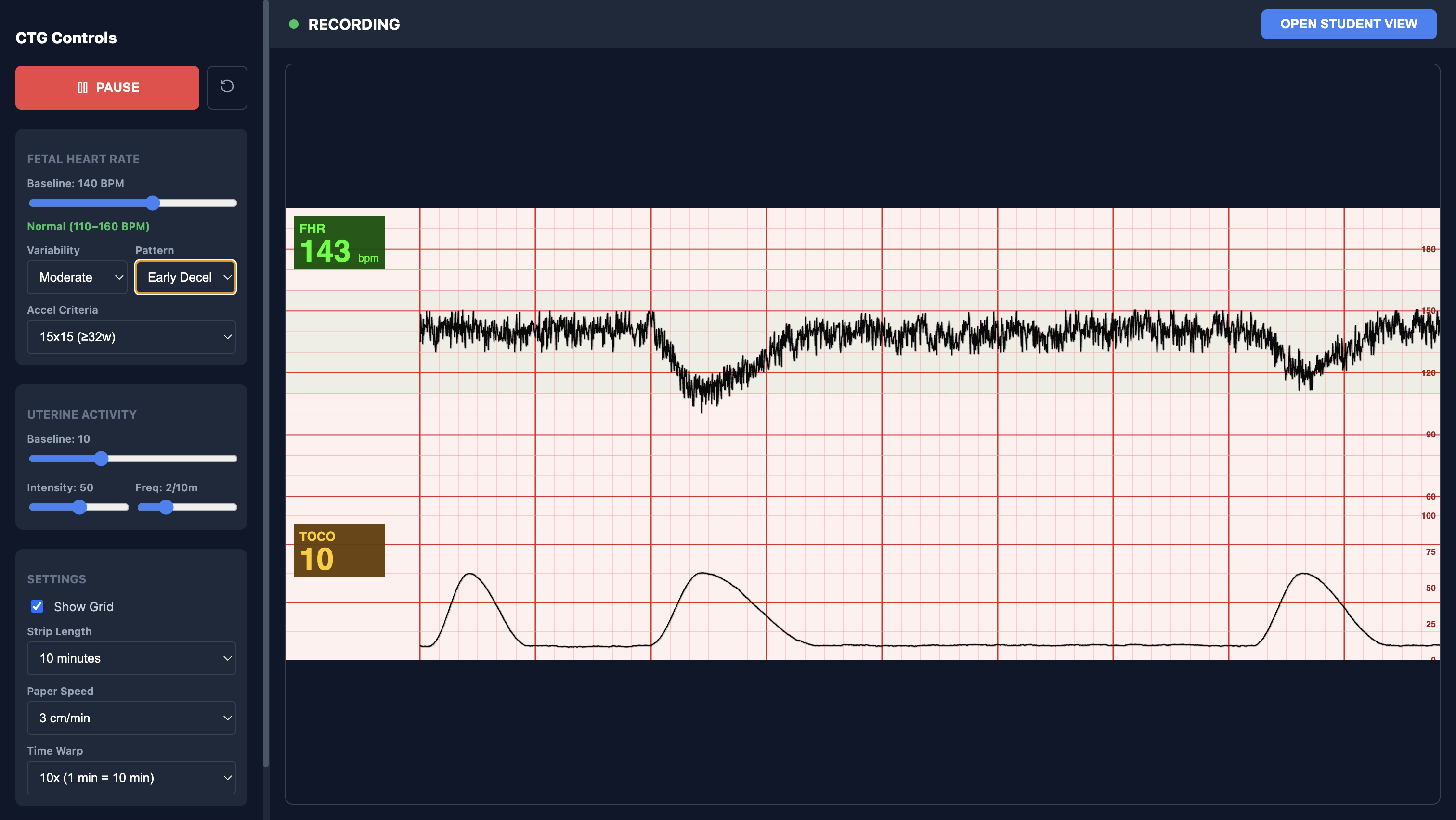 CTG SIM instructor console: controls on the left, live strip with FHR and TOCO channels on the right